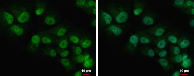 COMMD7 Rabbit Polyclonal Antibody
