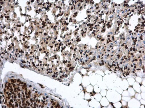 COMMD7 Rabbit Polyclonal Antibody