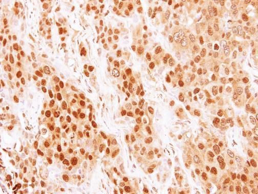 COMMD7 Rabbit Polyclonal Antibody