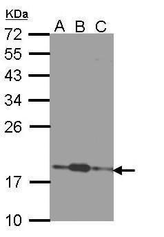 COMMD7 Rabbit Polyclonal Antibody
