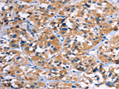 COMP Antibody