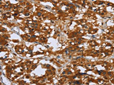 COMP Antibody