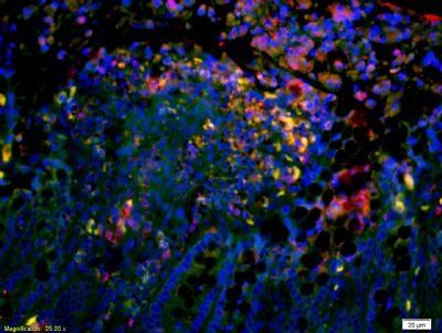 Complement C4 / C4a Rabbit Polyclonal Antibody
