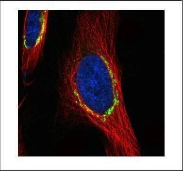 COPD Rabbit Polyclonal Antibody