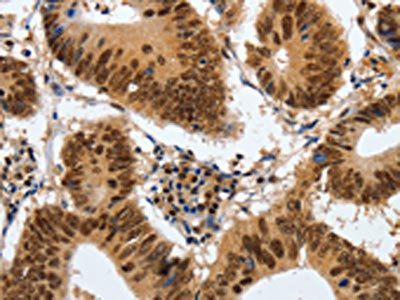 COPS5 Antibody