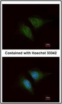 Coronin 1C Rabbit Polyclonal Antibody