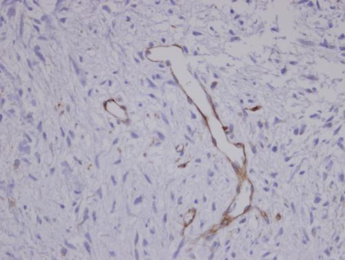 Coronin 1C Rabbit Polyclonal Antibody