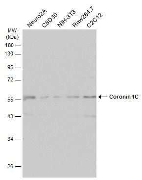 Coronin 1C Rabbit Polyclonal Antibody