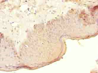 CRHR1 Antibody