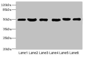 CRHR1 Antibody