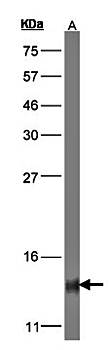 COX5B Rabbit Polyclonal Antibody