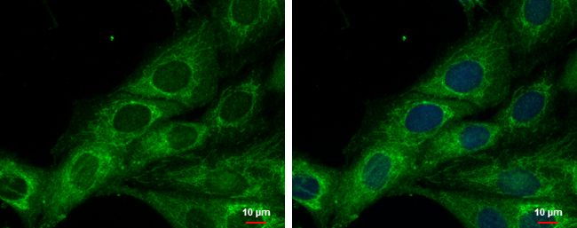 COX6A2 Rabbit Polyclonal Antibody