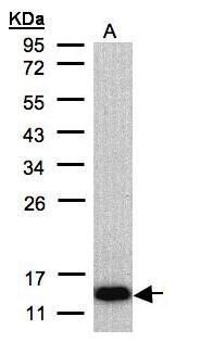 COX6A2 Rabbit Polyclonal Antibody