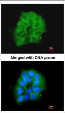 COX7B2 Rabbit Polyclonal Antibody