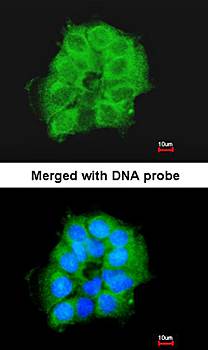 cytochrome c oxidase subunit VIIb2 precursor antibody