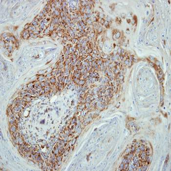 cytochrome c oxidase subunit VIIb2 precursor antibody
