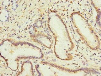 CPD Antibody