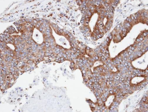 Copine 3 Rabbit Polyclonal Antibody