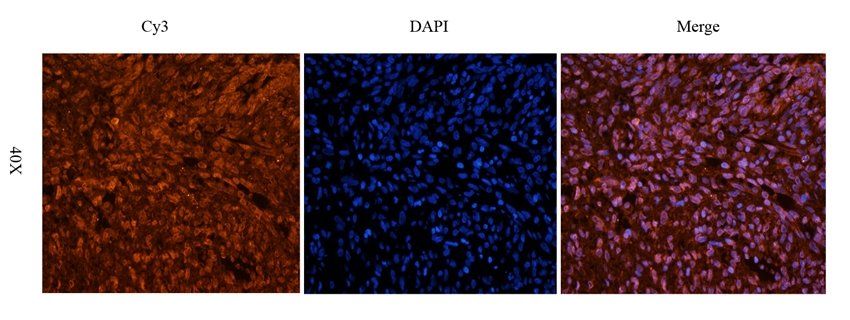 Cpt1a antibody
