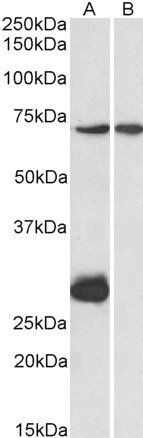 CPT2 (aa141-154) Antibody