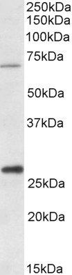 CPT2 (aa141-154) Antibody
