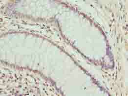 CPXCR1 Antibody