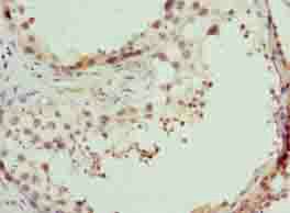 CPXCR1 Antibody