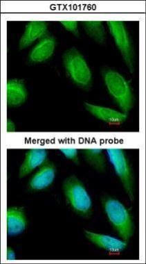 Creatine kinase Rabbit Polyclonal Antibody