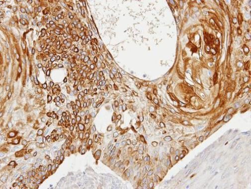 Creatine kinase Rabbit Polyclonal Antibody