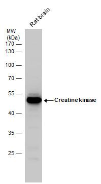 Creatine kinase Rabbit Polyclonal Antibody