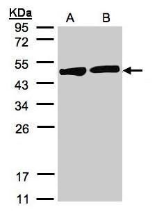 Creatine kinase Rabbit Polyclonal Antibody
