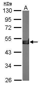 Creatine kinase Rabbit Polyclonal Antibody