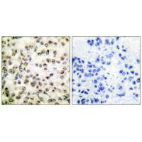 CREBBP Antibody