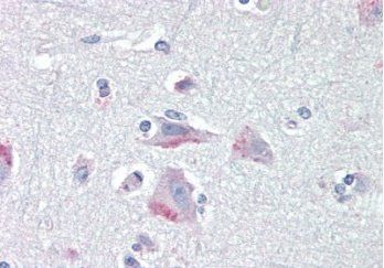 CRHR1/CRF-R (aa 250 - 263) Antibody