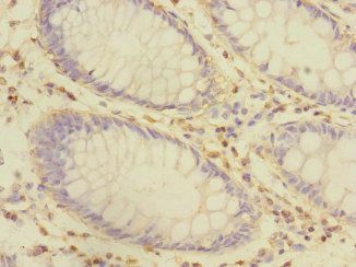 CRIP1 Antibody