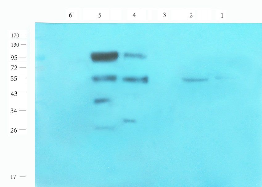 CRISP1 Rabbit Polyclonal Antibody