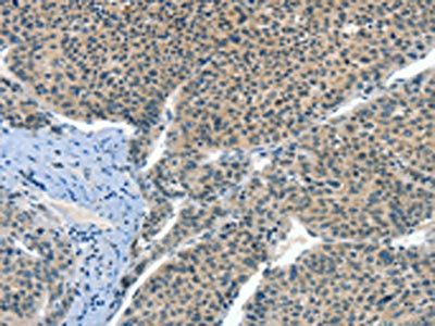 CRLF2 Antibody