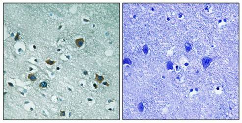 CRMP-2 (Phospho-Thr509) Antibody