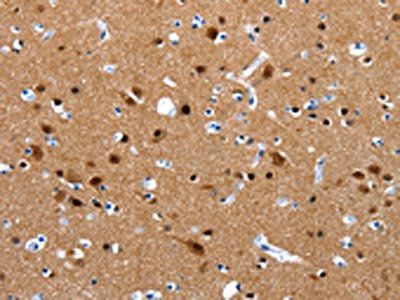 CRMP1 Antibody