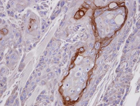 CROT Rabbit Polyclonal Antibody