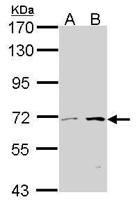 CROT Rabbit Polyclonal Antibody