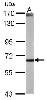 CROT Rabbit Polyclonal Antibody