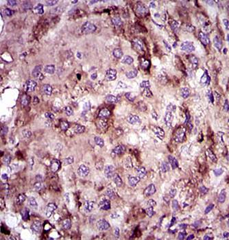 CRP Antibody