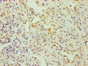 CRY1 Antibody