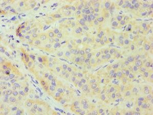 CRY1 Antibody