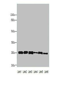 CRYBA1 Antibody