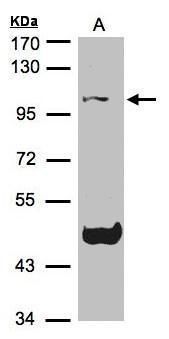 TCF19 Rabbit Polyclonal Antibody