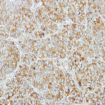 CSDE1 antibody