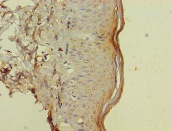 CSF2RA Antibody