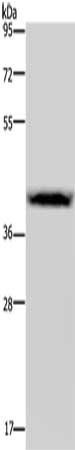 CSF2RA Antibody